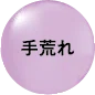 手荒れ